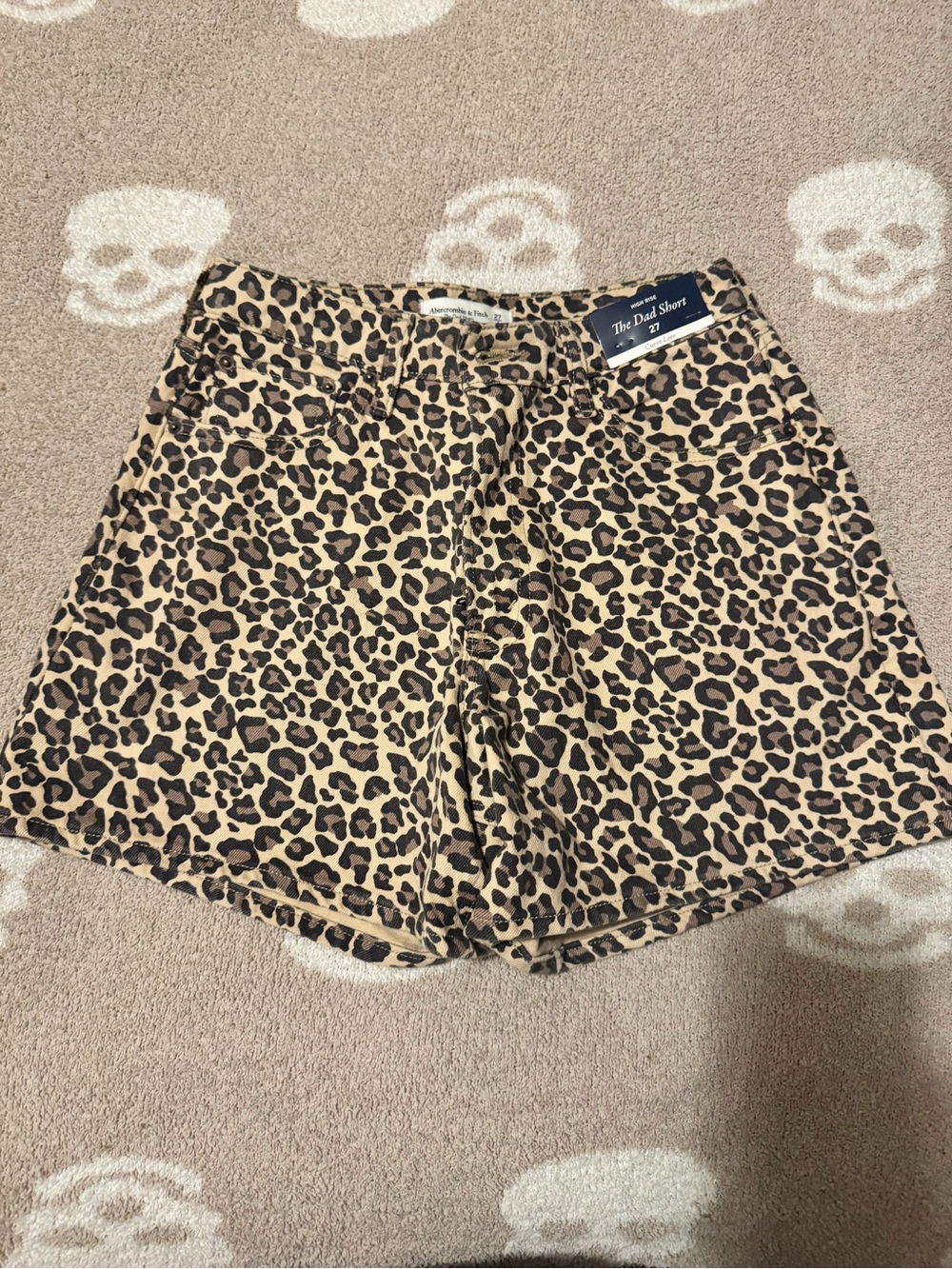 Abercrombie The Dad Short — Leopard Print Women’s Shorts